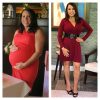 After Michelle's 2nd pregnancy, she was left with a major ventral hernia, Diastasis-Recti (separation of abdominal muscle and 40 lbs overweight on a 5'1 small boned body frame).